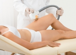 IPL-Behandlung – Tipps & Hinweise